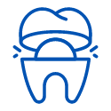 Dental Crowns and Dental Bridge