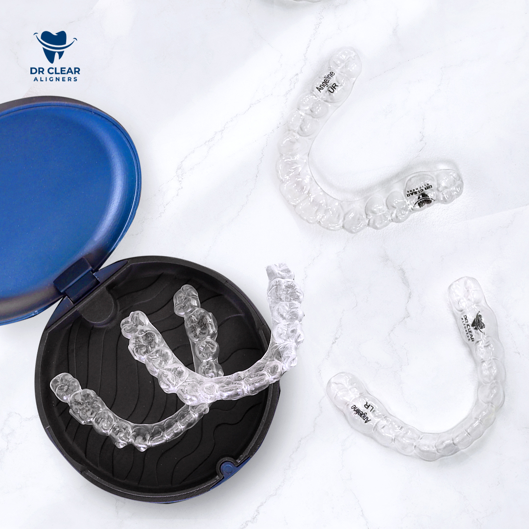 Aligners Replacement Set